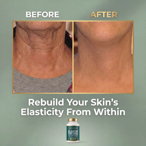 Vivira Elastin Peptide